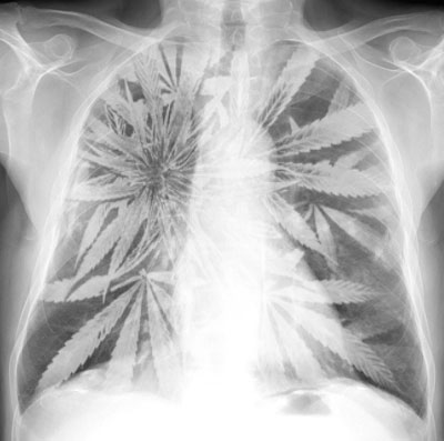 Marijuana Doesn't Harm Lungs? | Third Monk 
