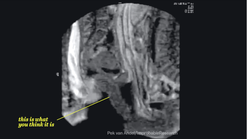 Interesting MRI research